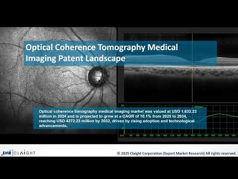 Global Optical Coherence Tomography Medical Imaging Patent Landscape Report 2025